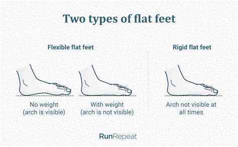 running shoes flexible flat feet